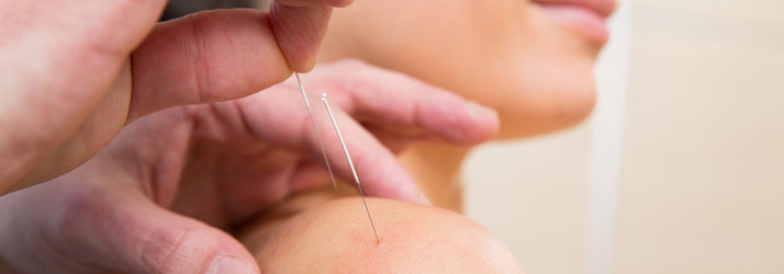 acupuncture Delores Cervicales en Wenatchee WA
